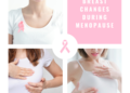How to Cope With Breast Changes During Menopause