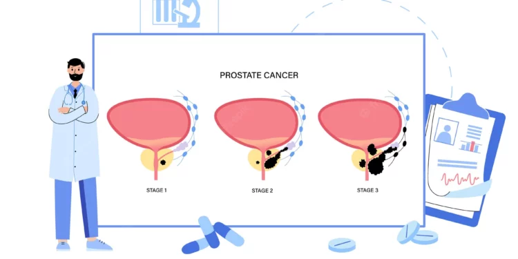 Supplements for Prostate Health